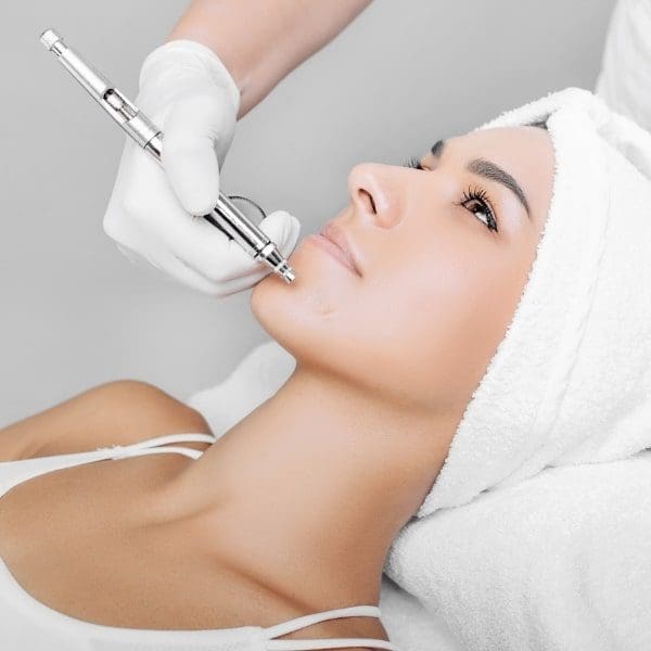 Tratamento com Peeling de Diamante